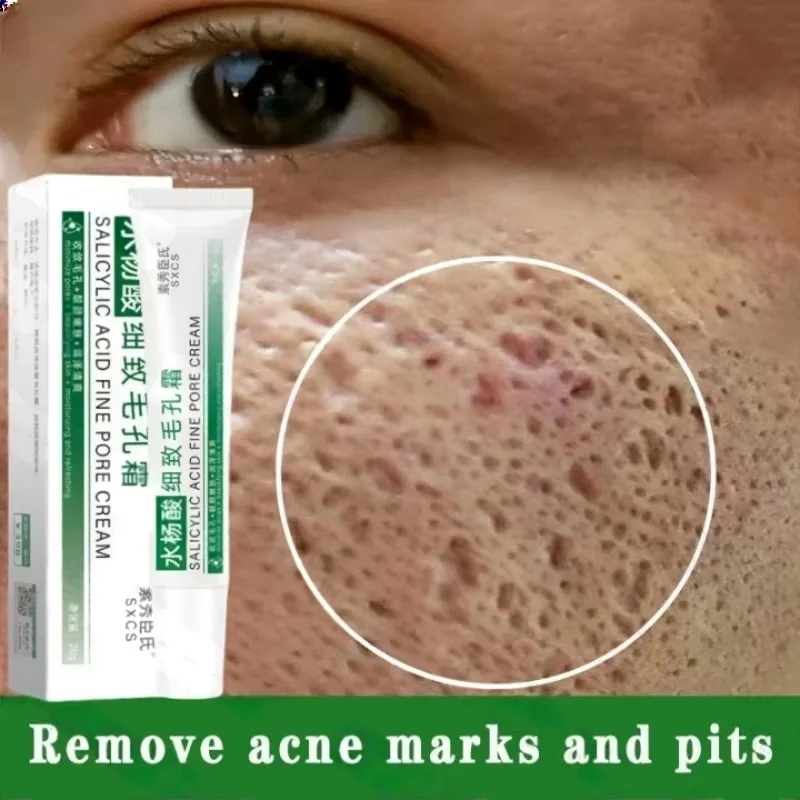 Crema per la pulizia dei pori  - Korean Skincare Routine recensione e prezzo