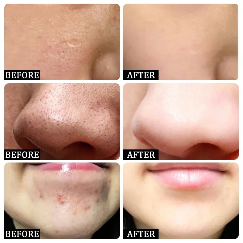 Crema per la pulizia dei pori  - Korean Skincare Routine recensione e prezzo