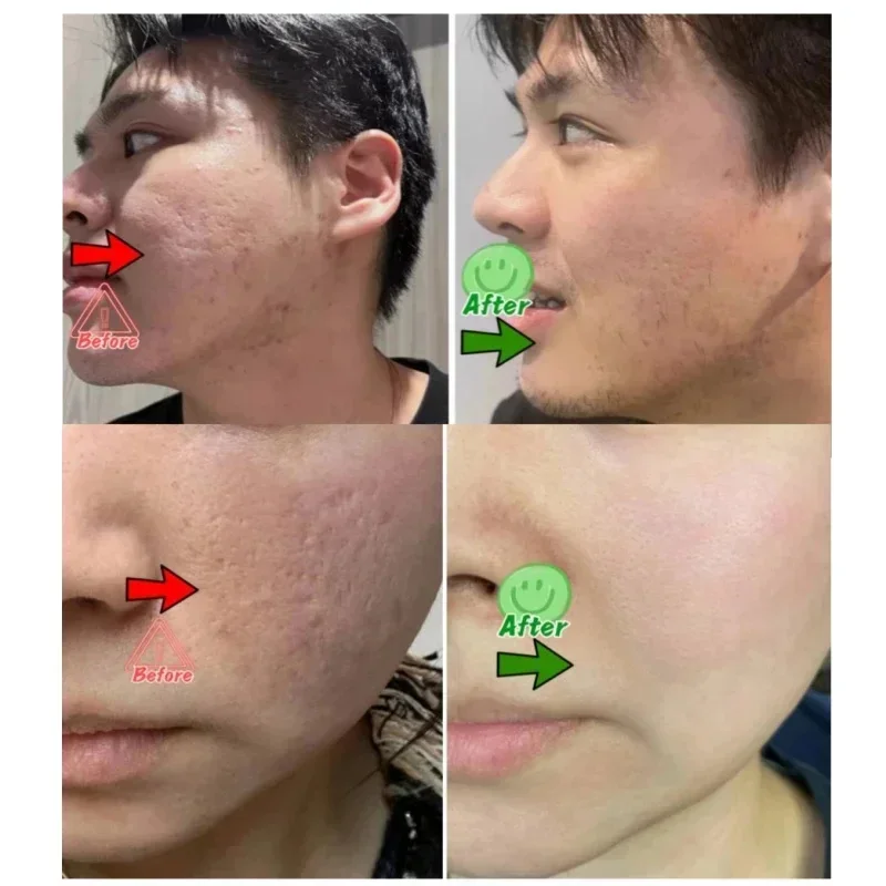 Crema per la pulizia dei pori  - Korean Skincare Routine recensione e prezzo